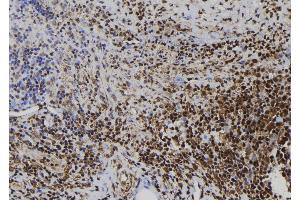 ABIN6272499 at 1/100 staining Human spleen tissue by IHC-P.