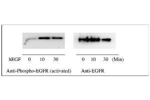 Image no. 8 for Epidermal Growth Factor Receptor (EGFR) ELISA Kit (ABIN1981829)