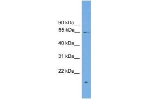 Image no. 1 for anti-Zinc Finger Protein 320 (ZNF320) (N-Term) antibody (ABIN2773978)