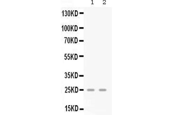 anti-Chemokine (C-X-C Motif) Ligand 3 (CXCL3) (AA 32-100) antibody