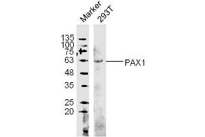 Image no. 3 for anti-Paired Box 1 (PAX1) (AA 151-250) antibody (ABIN673269)