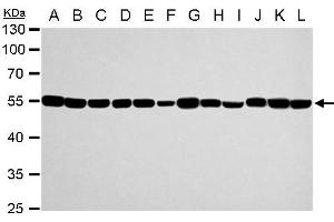 Image no. 7 for anti-Tubulin, alpha 1a (Tuba1a) (Center) antibody (ABIN2856707)