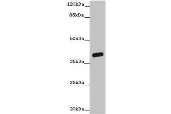 OGFOD2 Antikörper  (AA 1-186)