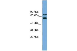 Image no. 1 for anti-YY1 Associated Protein 1 (YY1AP1) (Middle Region) antibody (ABIN2784323)