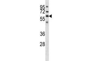 GPC3 antibody western blot analysis in NCI-H292 lysate.