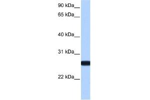 Image no. 1 for anti-Interleukin 13 Receptor, alpha 2 (IL13RA2) (N-Term) antibody (ABIN630522)