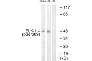 Image no. 1 for anti-ELK1, Member of ETS Oncogene Family (ELK1) (AA 356-405), (pSer389) antibody (ABIN1531827)