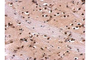 IHC-P Image MEF2A antibody [C2C3], C-term detects MEF2A protein at nucleus on rat fore brain by immunohistochemical analysis.