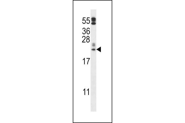 FAM213A anticorps  (C-Term)