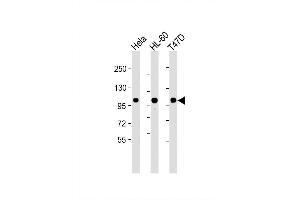Image no. 5 for anti-Enhancer of Zeste Homolog 2 (EZH2) antibody (ABIN659002)