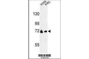 Image no. 1 for anti-Glutamine-Fructose-6-Phosphate Transaminase 2 (GFPT2) (AA 175-201) antibody (ABIN653230)