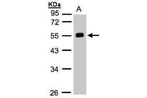 Image no. 3 for anti-Angiotensinogen (serpin Peptidase Inhibitor, Clade A, Member 8) (AGT) antibody (ABIN2133686)
