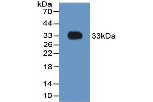 Prothrombin 抗体  (AA 324-617)