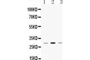 Image no. 1 for anti-Major Histocompatibility Complex, Class II, DP beta 1 (HLA-DPB1) (AA 30-258) antibody (ABIN4886618)