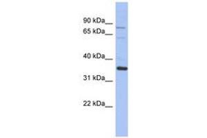 Image no. 1 for anti-NRBP2 (NRBP2) (AA 422-471) antibody (ABIN6744325)
