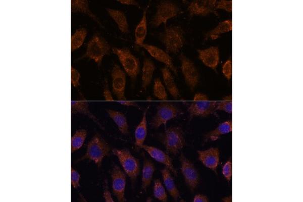 SUCLG1 anticorps  (AA 41-346)