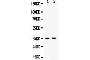 Image no. 3 for anti-Apolipoprotein E (APOE) (AA 55-294) antibody (ABIN4886470)