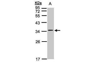 WB Image Sample(30 ug whole cell lysate) A:Hep G2 , 12% SDS PAGE antibody diluted at 1:1000
