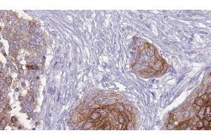 Image no. 3 for anti-Fc Fragment of IgG, Low Affinity IIIa, Receptor (CD16a) (FCGR3A) antibody (ABIN6261703)