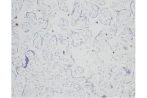Image no. 2 for anti-Resistin (RETN) antibody (ABIN181156)