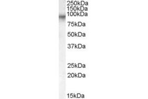 Image no. 1 for anti-Coagulation Factor XIII, A1 Polypeptide (F13A1) (Internal Region) antibody (ABIN238563)