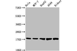 Western Blotting (WB) image for anti-Peripheral-Type Benzodiazepine Receptor (TSPO) antibody (ABIN7127858)