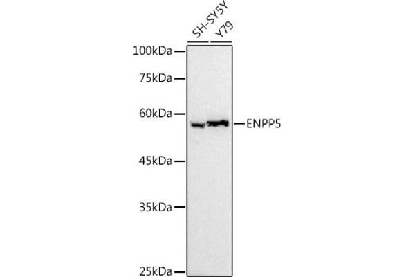 ENPP5 抗体