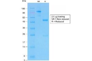 Image no. 1 for anti-Cystic Fibrosis Transmembrane Conductance Regulator (ATP-Binding Cassette Sub-Family C, Member 7) (CFTR) (AA 258-385) antibody (ABIN6939095)