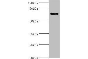 SLC27A6 antibody  (AA 370-619)