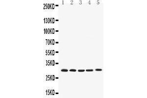 Image no. 1 for anti-BCL2-Like 1 (BCL2L1) (AA 1-219) antibody (ABIN5518741)