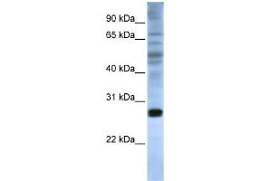 Image no. 1 for anti-Eukaryotic Translation Initiation Factor 4E (EIF4E) (C-Term) antibody (ABIN2778784)