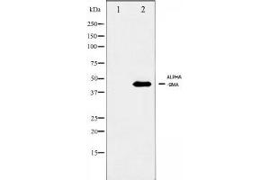 Image no. 4 for anti-Actin, alpha 2, Smooth Muscle, Aorta (ACTA2) (N-Term) antibody (ABIN6254917)