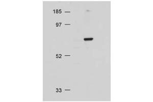 Image no. 3 for anti-V-Akt Murine Thymoma Viral Oncogene Homolog 1 (AKT1) (C-Term) antibody (ABIN94783)