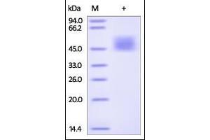 Image no. 2 for Interleukin 21 Receptor (IL21R) (AA 20-236) (Active) protein (His tag) (ABIN2181372)