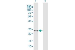 Western Blot analysis of RTN3 expression in transfected 293T cell line by RTN3 MaxPab polyclonal antibody.