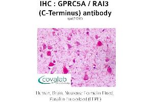 Image no. 1 for anti-G Protein-Coupled Receptor, Family C, Group 5, Member A (GPRC5A) (C-Term) antibody (ABIN1735208)