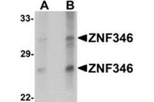 Image no. 1 for anti-Zinc Finger Protein 346 (ZNF346) (C-Term) antibody (ABIN783401)