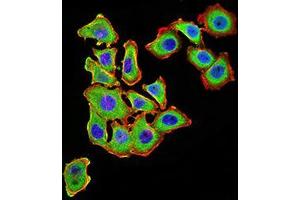 Image no. 3 for anti-Uncoupling Protein 3 (Mitochondrial, Proton Carrier) (UCP3) (AA 1-113) antibody (ABIN5542343)