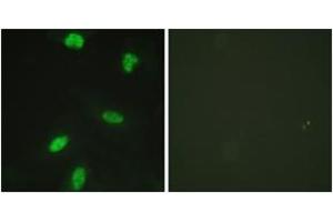 Image no. 2 for anti-Retinoblastoma Protein (Rb Protein) (AA 791-840), (pThr821) antibody (ABIN1531516)