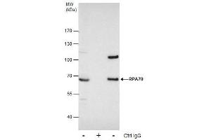 Image no. 1 for anti-Replication Protein A1, 70kDa (RPA1) (C-Term) antibody (ABIN2856633)