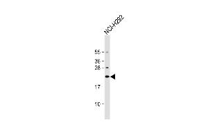 Anti-DNAJC5G Antibody (Center) at 1:1000 dilution + NCI- whole cell lysate Lysates/proteins at 20 μg per lane.