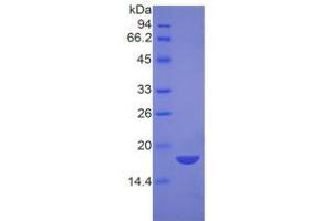 Image no. 3 for Nucleophosmin (Nucleolar phosphoprotein B23, Numatrin) (NPM1) ELISA Kit (ABIN6574308)