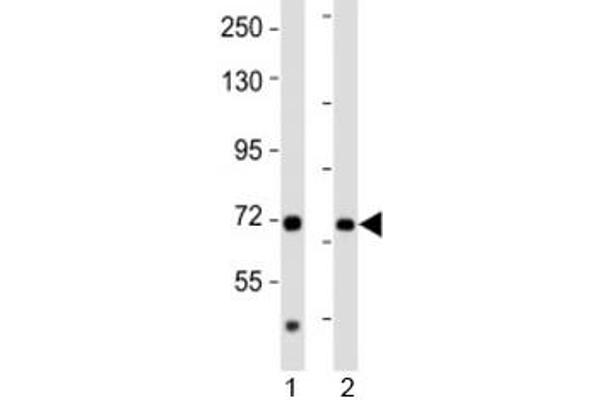 anti-Acetoacetyl-CoA Synthetase (AACS) (AA 539-573) antibody