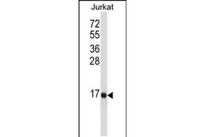 Image no. 1 for anti-Tachykinin 3 (TAC3) (AA 54-83) antibody (ABIN5531734)