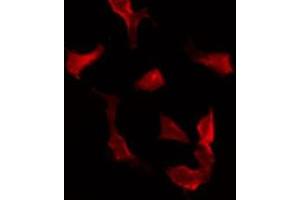 Image no. 2 for anti-Synaptotagmin XVI (SYT16) antibody (ABIN6257875)