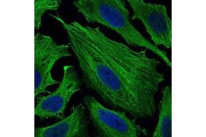 Image no. 1 for anti-Sperm Mitochondria Associated Cysteine Rich Protein (SMCP) antibody (ABIN5588425)