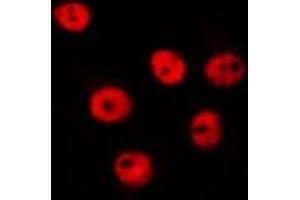Image no. 1 for anti-Splicing Factor, Suppressor of White-Apricot Homolog (SFSWAP) (N-Term) antibody (ABIN6259188)