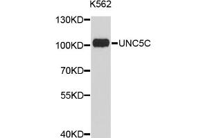 Image no. 1 for anti-Unc-5 Homolog C (C. Elegans) (Unc5c) antibody (ABIN1875282)