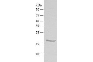 CDH15 Protein (AA 61-246) (His tag)