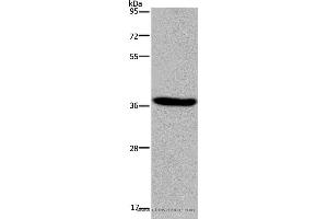 Image no. 2 for anti-Potassium Channel, Subfamily K, Member 17 (KCNK17) antibody (ABIN2423691)